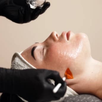 Advanced Resurfacing Program (3) at Enhanced Beauty by Madison Taylor in Spring, TX